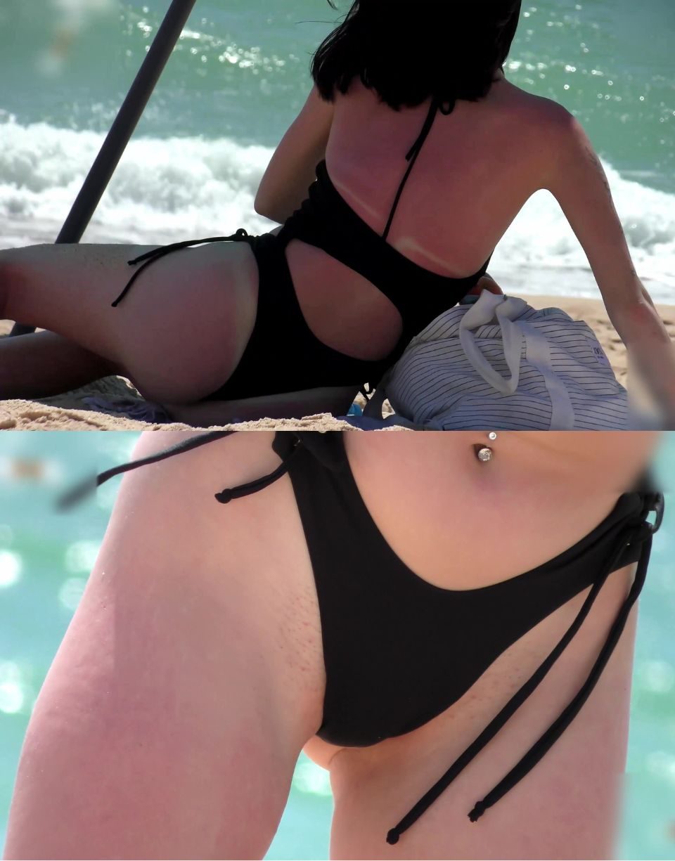 She has a Sunburn